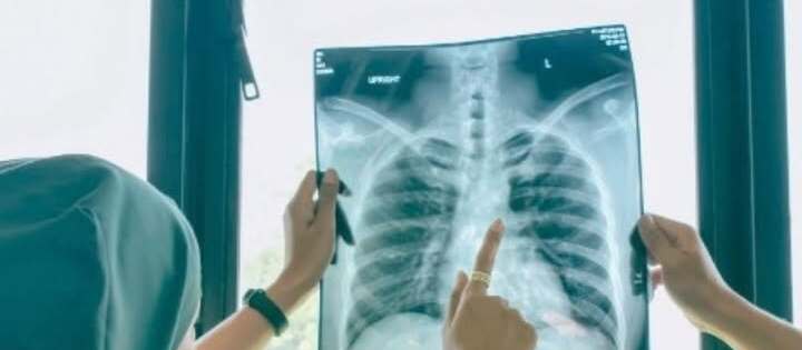 Tingginya Kasus Gangguan Saluran Napas Kronis di Blitar: Menghadapi Polusi dan Penyakit Paru