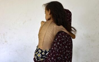 PBB Tetapkan Gaza Dalam Bencana Kelaparan